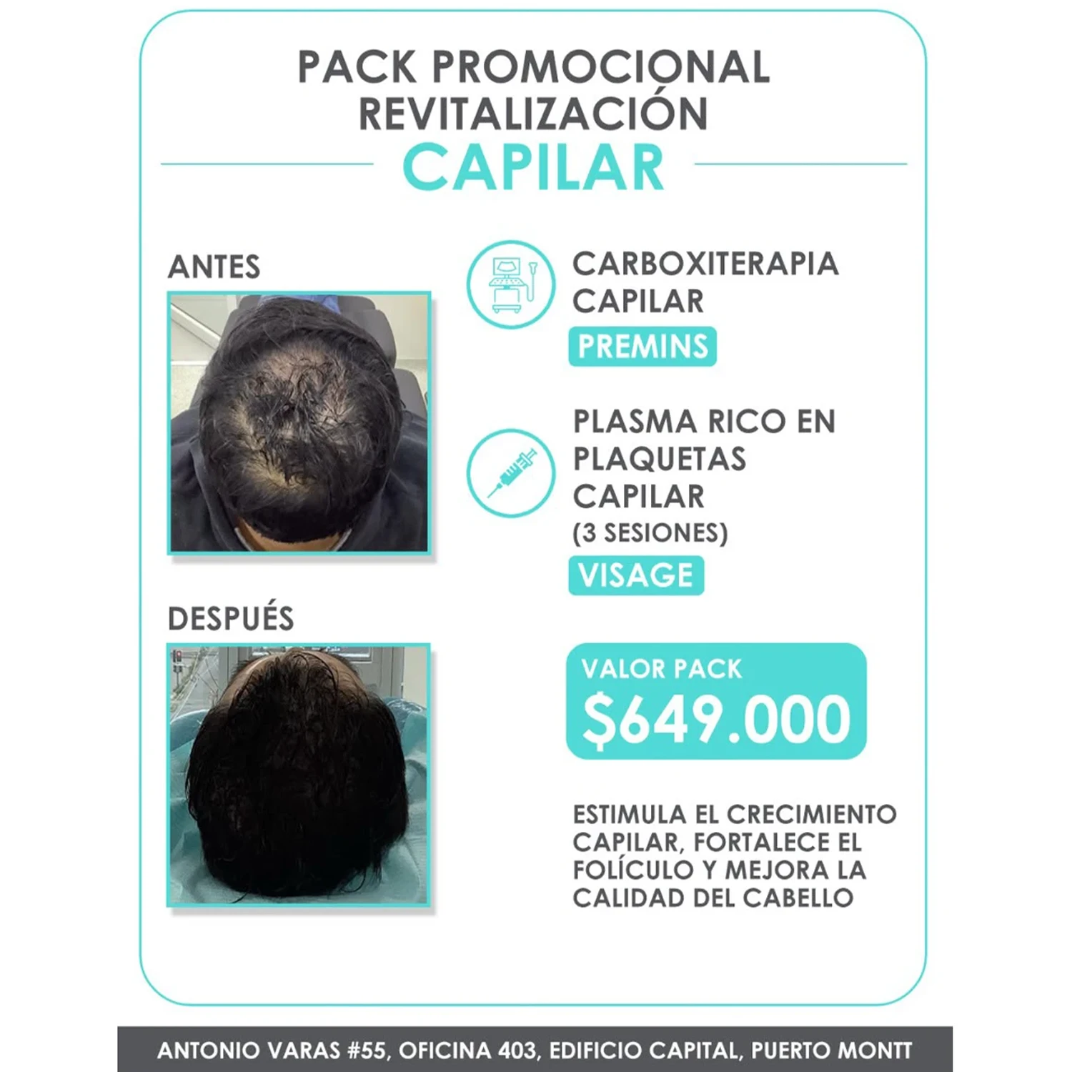 PACK-capilar Pack Promocional: Revitalización Capilar - Imagen 1