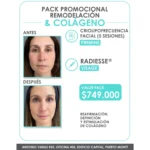 Pack Promocional: Remodelación y Colágeno