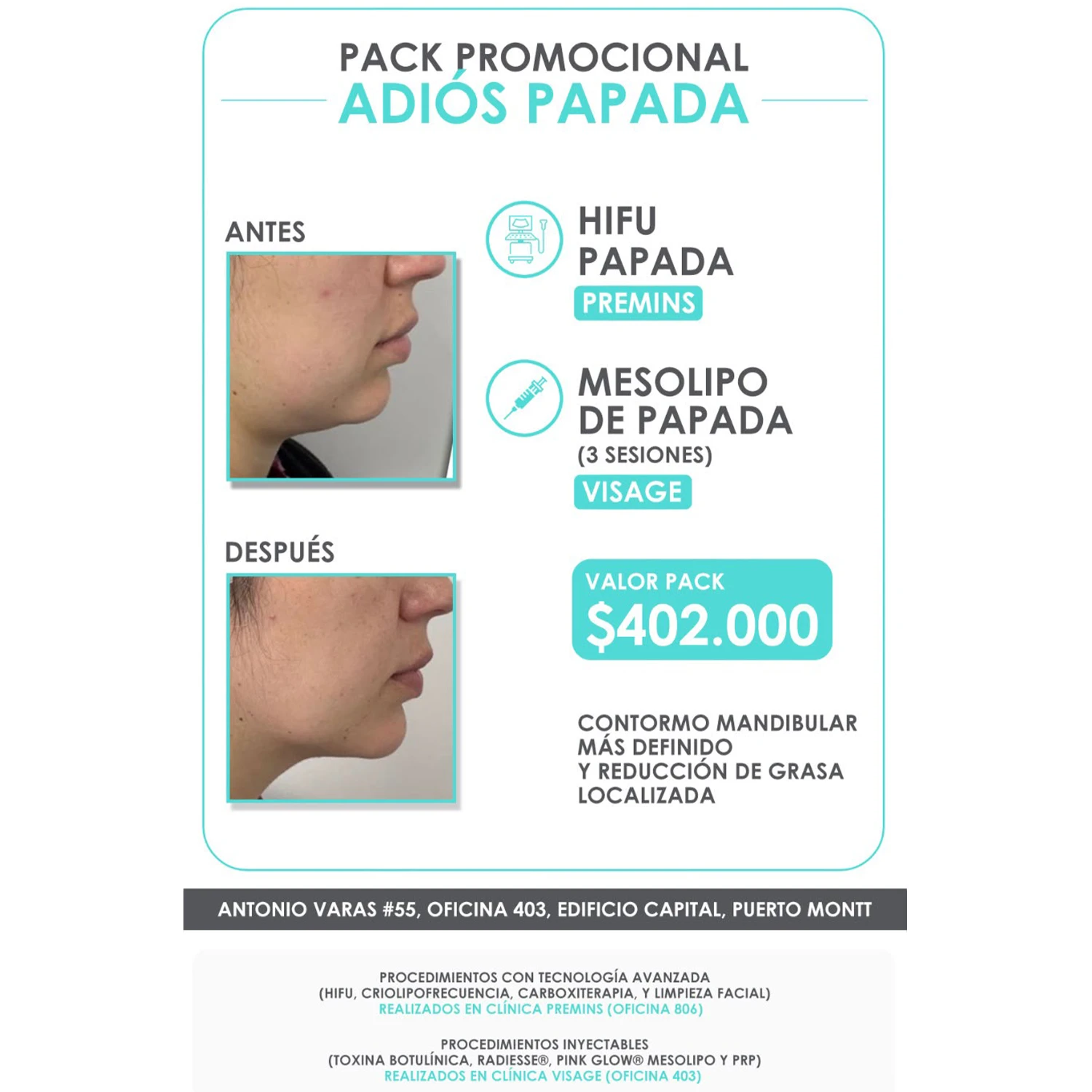 promociona-adios-papada Pack Promocional: Adiós Papada - Imagen 1