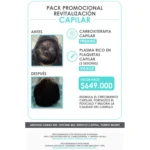 Pack Promocional: Revitalización Capilar