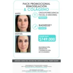 Pack Promocional: Remodelación y Colágeno