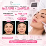 Promociones Estética Facial: Tratamiento Jovena (4 sesiones) + Pink Glow (3 sesiones)